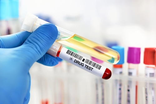 Essential Pre-Employment Screenings – Beyond the Criminal Background Check
